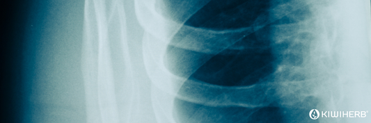 Understanding Left Side Rib Cage Swelling